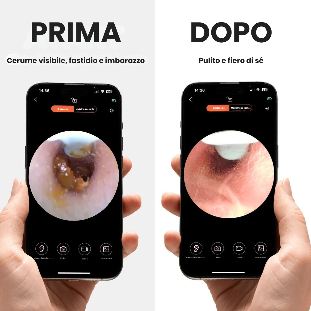 Elovya - Earo Vision 1.0