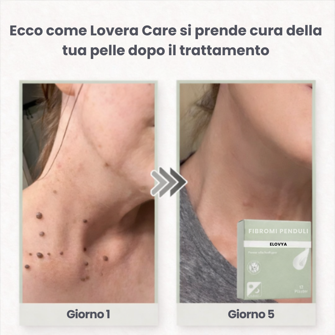 Elovya - Patch per Imperfezioni Cutanee
