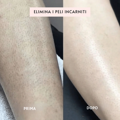 SILKLY™ - Tagliapeli Elettrico Femminile