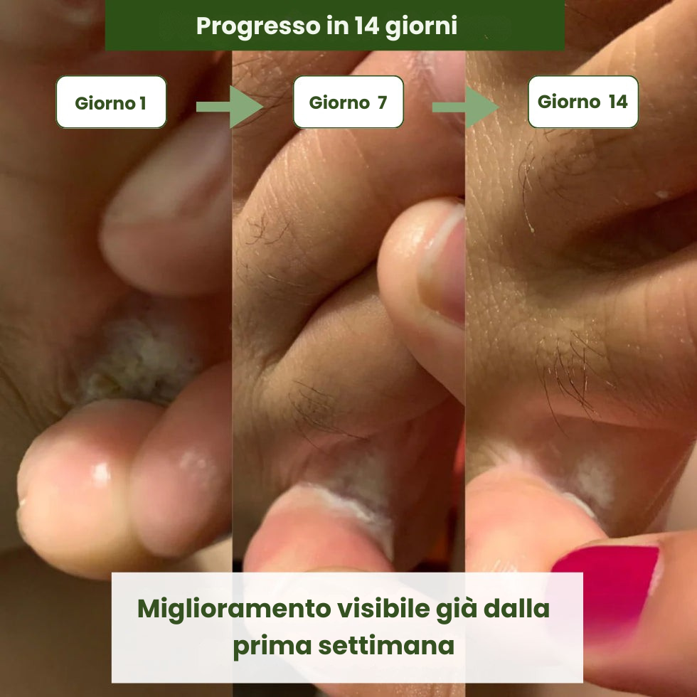 Sapone Antimicotico Verdalyae
