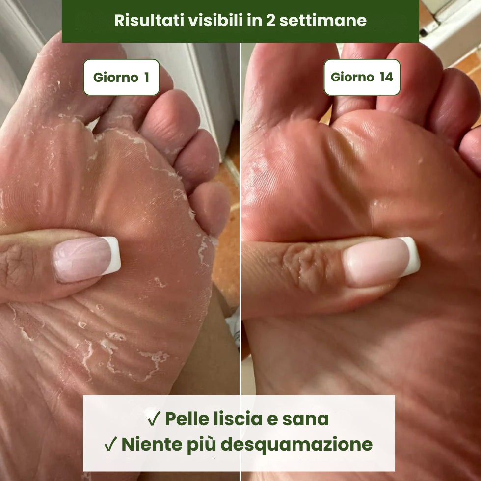 Sapone Antimicotico Verdalyae