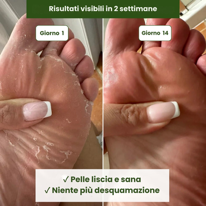 Sapone Antimicotico Verdalyae