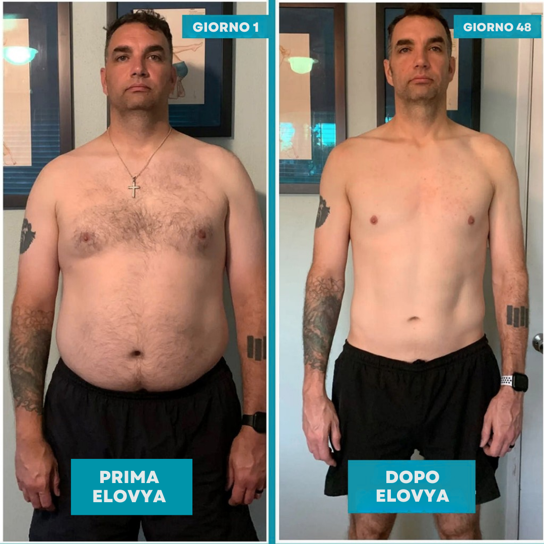 Elovya 2.0 - Body Snellente e Correttore Postura