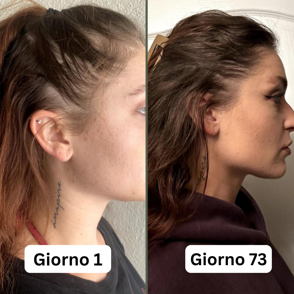 Siero per la crescita dei capelli (60 ml)