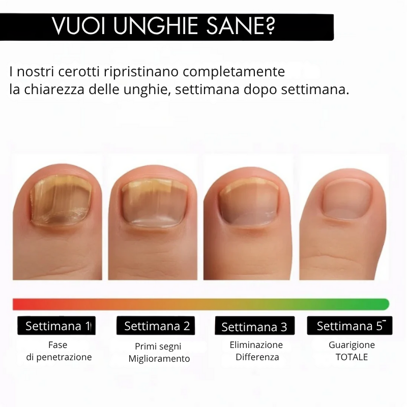 RinovaNail™ - Unghie sane, giorno dopo giorno