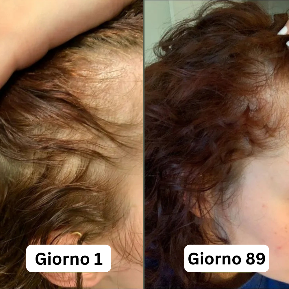 Siero per la crescita dei capelli (60 ml)