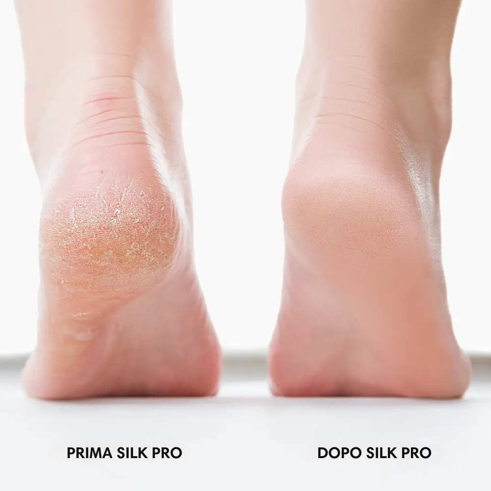 Bliss Silk Pro - Piedi morbidi senza costosi trattamenti in salone