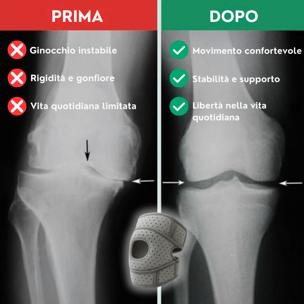 OrthoKnee Pro™ – Per una vita quotidiana senza dolori alle ginocchia