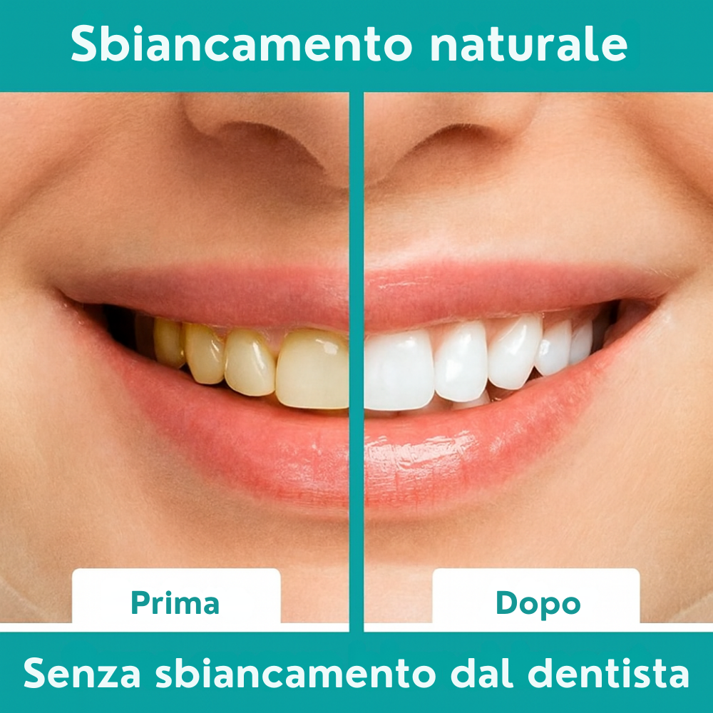 Strisce Sbiancanti Naturali Elovya – All’Olio di Cocco, Senza Dolore, Risultati in 7 Giorni
