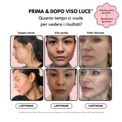VISO LUCE™ - Rinnova, solleva, illumina