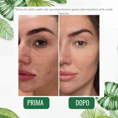 Stick Detox - Visibile contro Imperfezioni e Pori