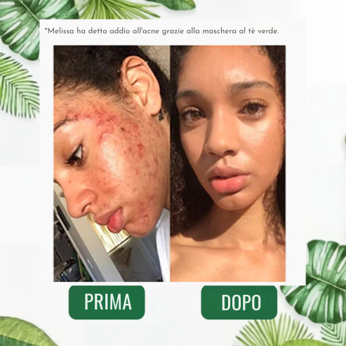 Stick Detox - Visibile contro Imperfezioni e Pori