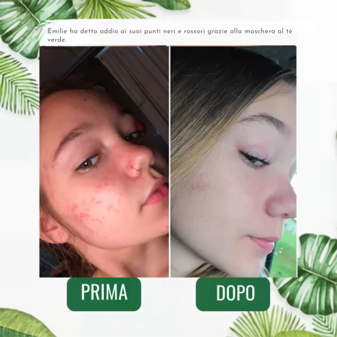 Stick Detox - Visibile contro Imperfezioni e Pori