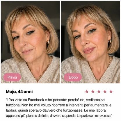 Rimpolpatore labbra Elovya