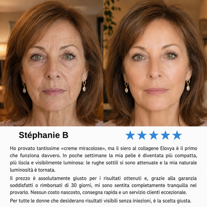 Elovya | Siero coreano al collagene per pelli mature
