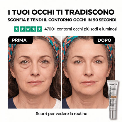 Elovya tensore occhi